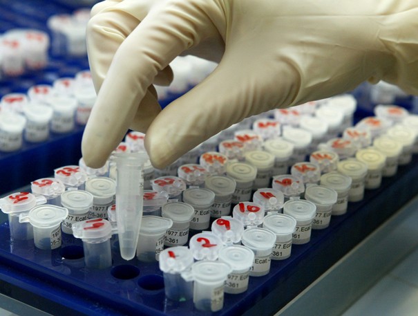 Des tubes contenant des échantillons destinés à une analyse ADN. | Crédits Photo : Michaela Rehle /REUTERS